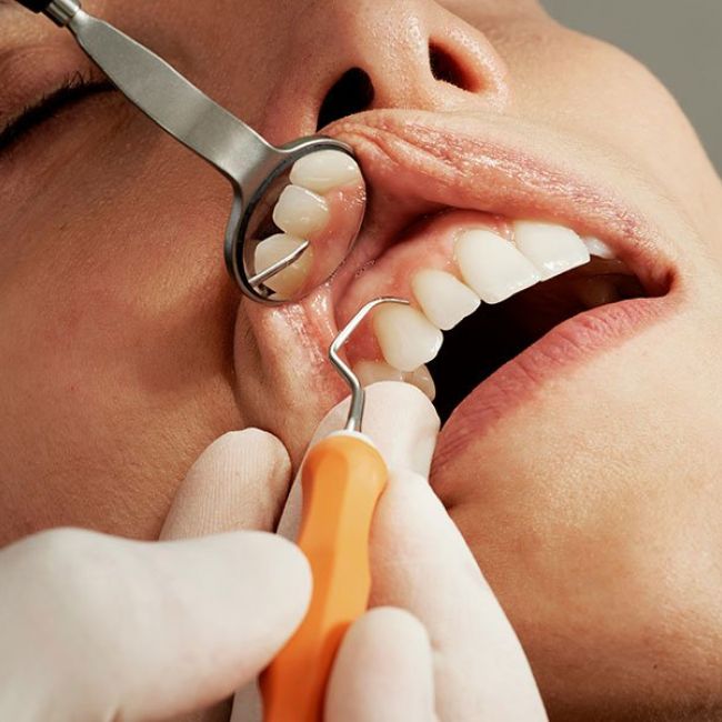 Periodoncia