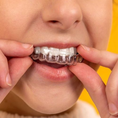 Ortodoncia invisible
